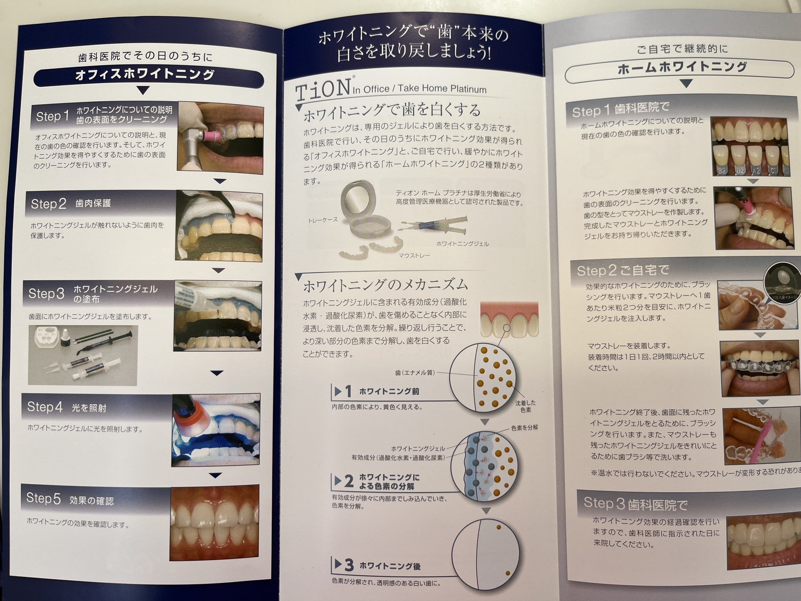 ホワイトニング