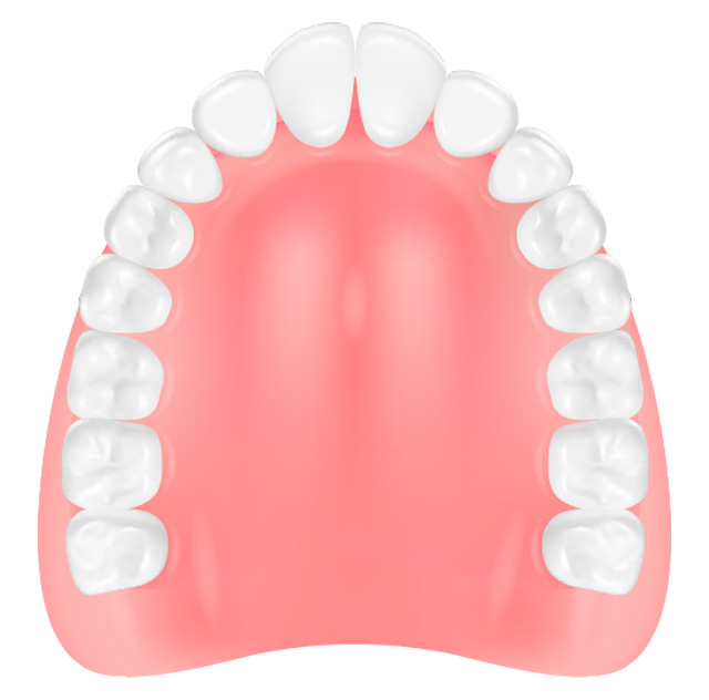 denture