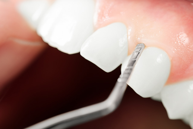 歯のぐらつきを確認する様子